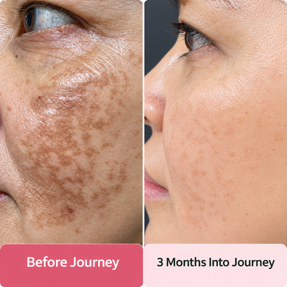 Vital515 TXA + Niacinamide Dark Spot Corrector Serum