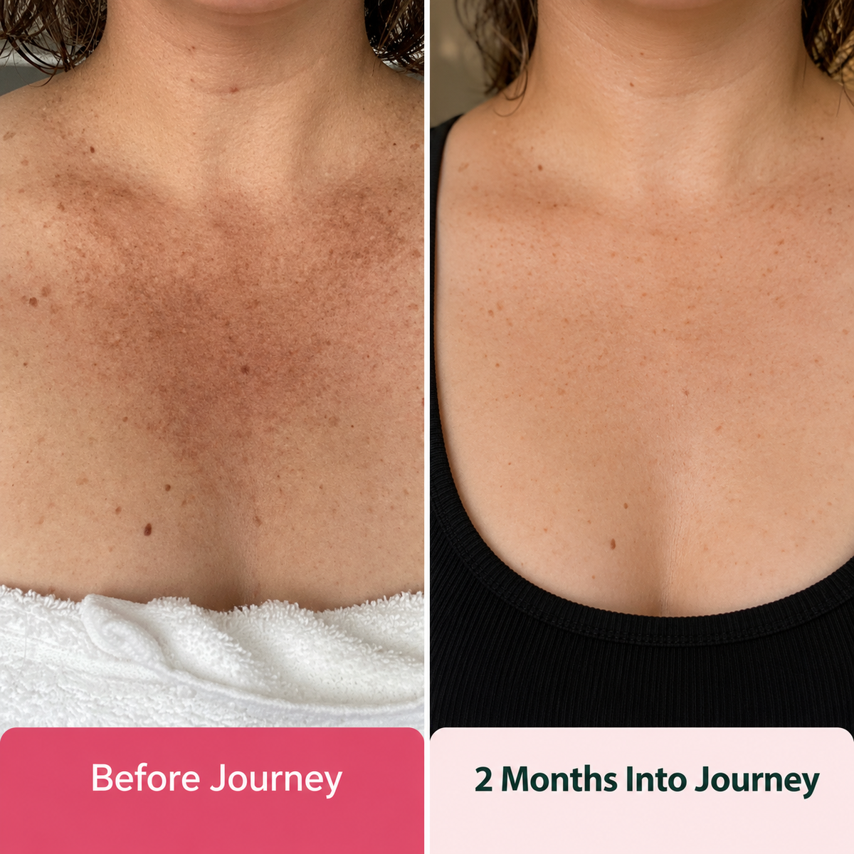 Vital515 TXA + Niacinamide Dark Spot Corrector Serum